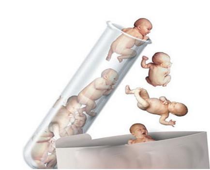 体外受精 IVF-ET